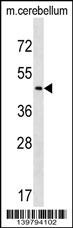 CHST2 Antibody