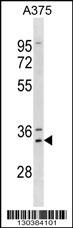 MSX1 Antibody