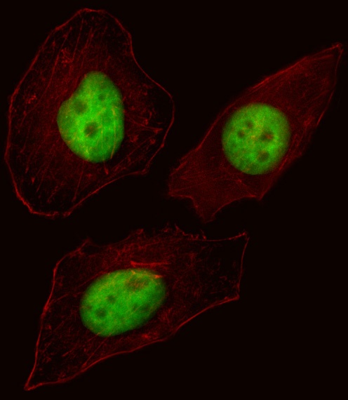 FOXN3 Antibody