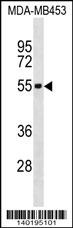 IL5RA Antibody