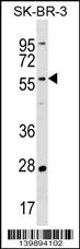 TAF6L Antibody