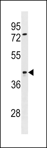SIRPB2 Antibody