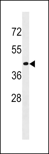 CD200R1L Antibody