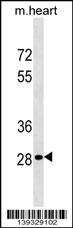 HOXB13 Antibody