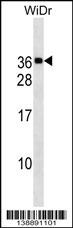 MED30 Antibody