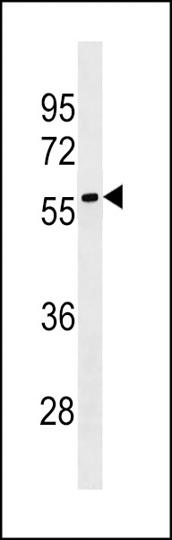 LRRC69 Antibody