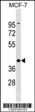 DMRT1 Antibody
