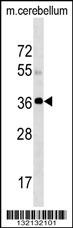 SLC25A20 Antibody