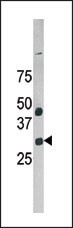 GAS41 Antibody