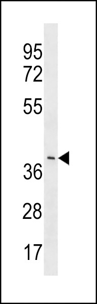 YV012 Antibody
