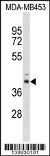 TRMU Antibody
