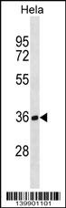 TBCB Antibody