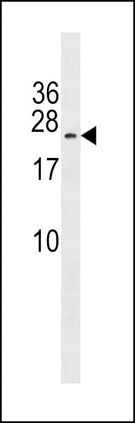 MAP3K7CL Antibody