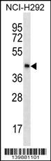 SPESP1 Antibody
