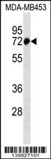 ZNF326 Antibody