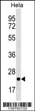 RPL10 Antibody