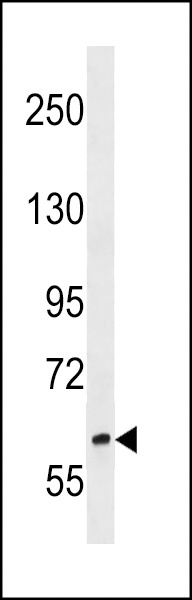 RREB1 Antibody