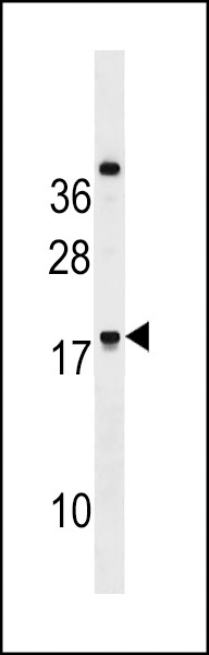RNF224 Antibody