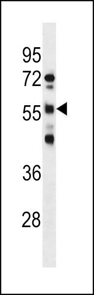 RBMY1D Antibody