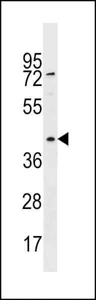 RBMXL1 Antibody