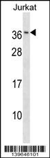 RAB8B Antibody