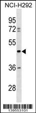 TULP3 Antibody