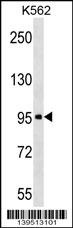 ABI3BP Antibody