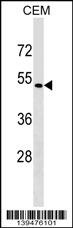 SSTR5 Antibody
