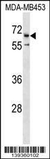 CATSPER2 Antibody