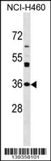 NAT6 Antibody