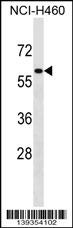 ZNF37A Antibody