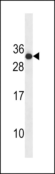 RAB4B Antibody