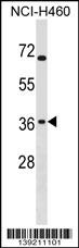 ST6GALNAC4 Antibody