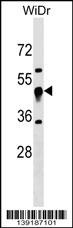 UQCRC1 Antibody