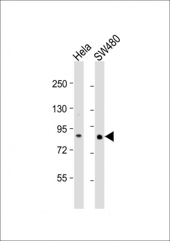 SLCO1B3 Antibody