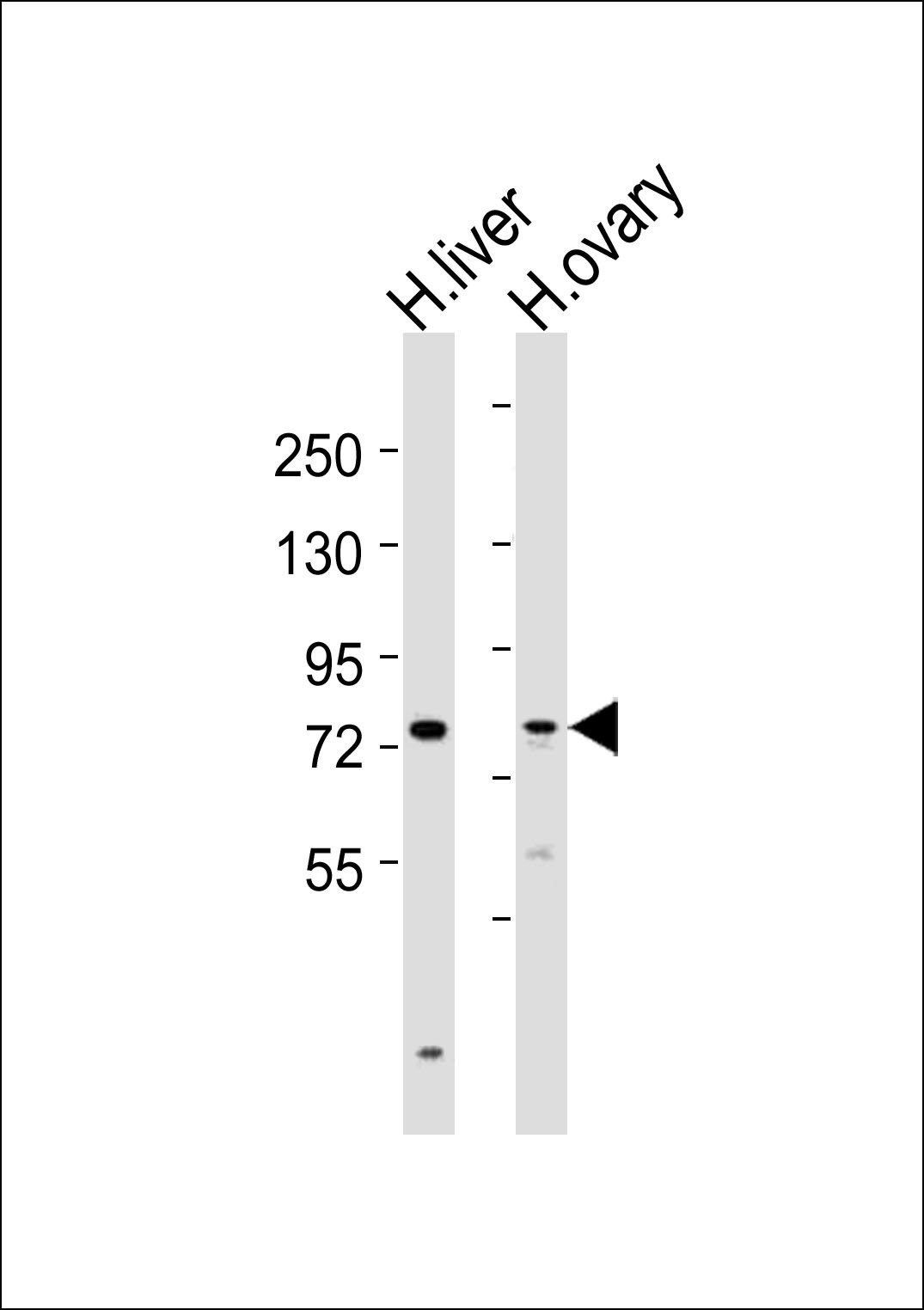 SLCO1B3 Antibody