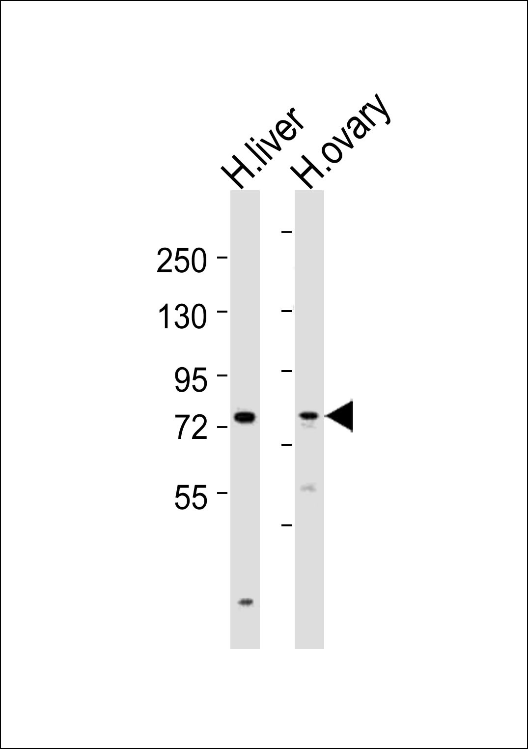 SLCO1B3 Antibody