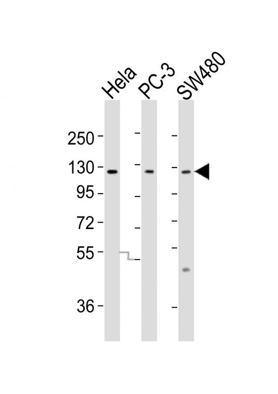 SLCO1B3 Antibody
