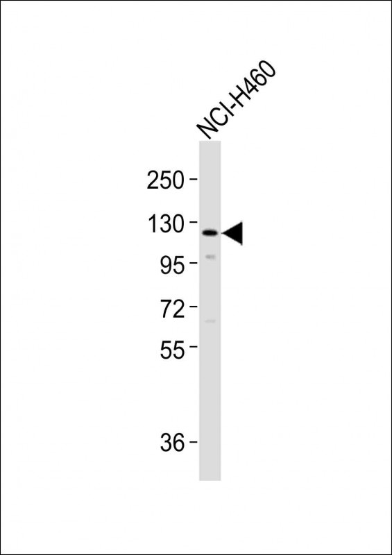 SLCO1B3 Antibody