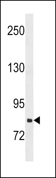 SLCO1B3 Antibody