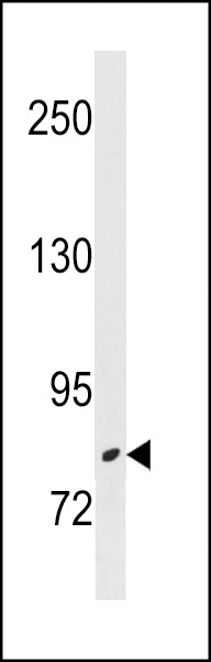 ZBTB17 Antibody