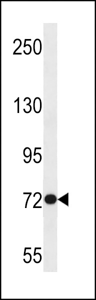 ANKRD56 Antibody