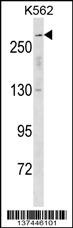 SCN5A Antibody