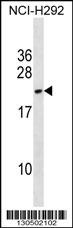 DYDC2 Antibody