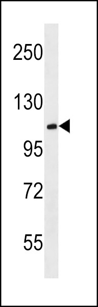 MBD6 Antibody