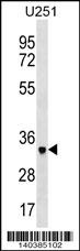 NPL Antibody
