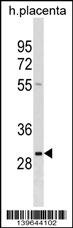 RAB22A Antibody