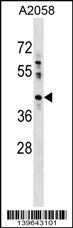 PTPLAD1 Antibody