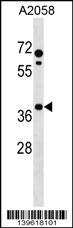 PHLDA1 Antibody