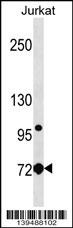 LCP1 Antibody